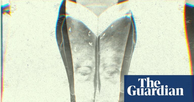 Puffy legs, heavy aches, rippled skin: what is lipedema? | well actually