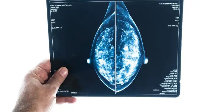 These are the canadian regions with the highest rates of breast cancer - national These are the canadian regions with the highest rates of breast cancer - national