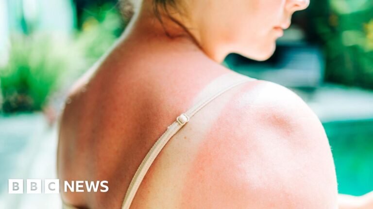 Riskiest skin cancer cases hit uk record high
