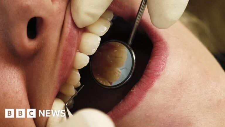 Australia: patients of retired sydney dentist warned of viruses including hepatitis and hiv