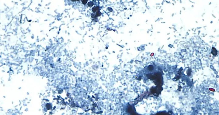 Where cyclosporiasis cases stand in canada as u. S. Parasite outbreak rages Where cyclosporiasis cases stand in canada as u. S. Parasite outbreak rages