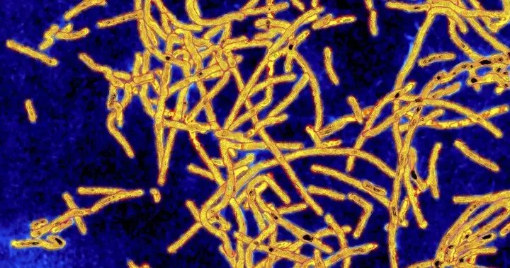Legionnaires’ bacteria found in new york museum cooling systems: report - national Legionnaires’ bacteria found in new york museum cooling systems: report - national